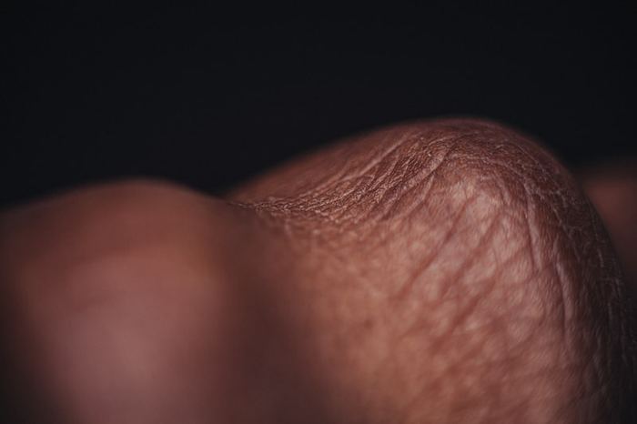 Macro de pele humana em detalhe